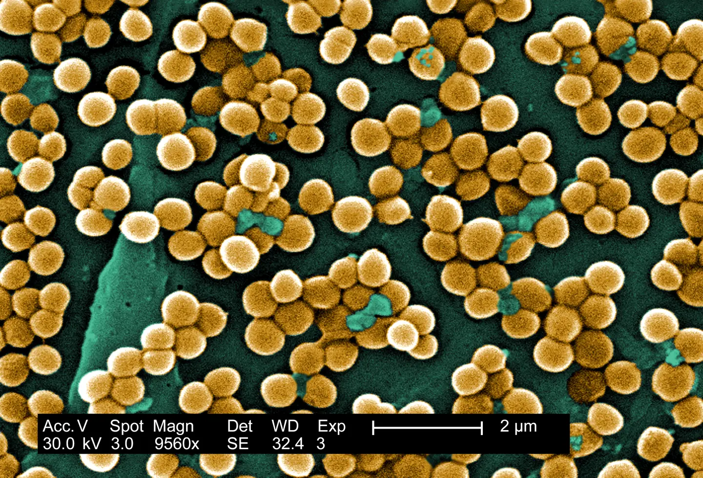 Dozens of round, gold-colored bacteria gathered in small grape-like clusters on a dark teal surface, with a black instrument strip along the bottom that shows the magnification and a 2 µm scale bar.