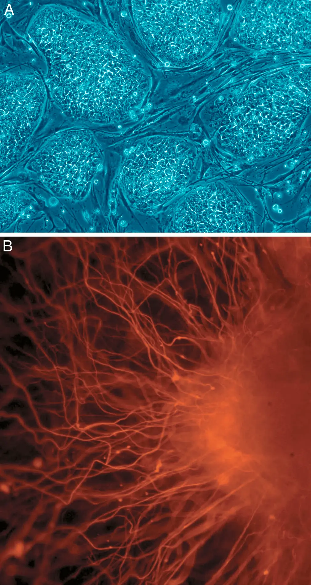Two microscope images, one above the other. Top, labelled A: rounded, tightly packed colonies of small cells in blue-green, separated by thin, stretched-out cells. Bottom, labelled B: a dense web of thin orange fibers fanning out from a bright cluster on a dark background.